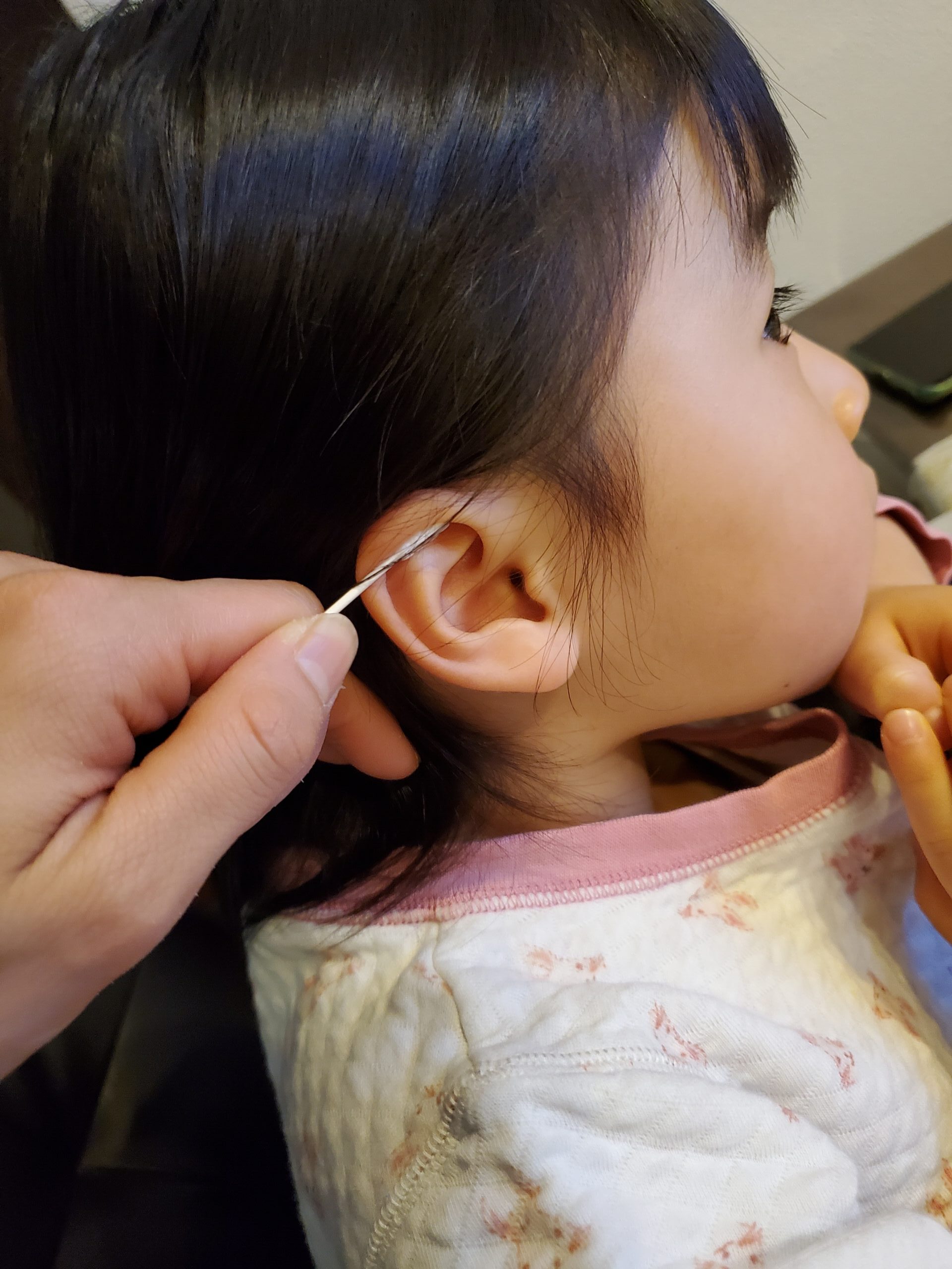耳掃除のためだけに！鈴木耳鼻咽喉科医院で驚きの耳垢取り体験